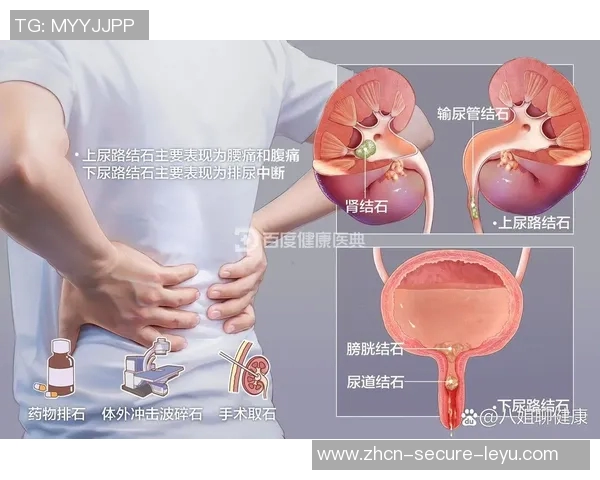 足球泌尿健康：如何预防运动中常见的泌尿系统问题与损伤